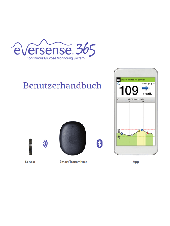 Die Eversense Bedienungsanleitung zeigt eine App für Glukosemessgeräte mit einer Anzeige von 109 mg/dL, einen CGM-Sensor und einem Smart Transmitter.