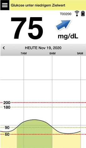 App Screen zeigt den Glukosewert „75 mg/dL“ mit einem Diagramm an, das Werte unterhalb des Zielbereichs anzeigt.